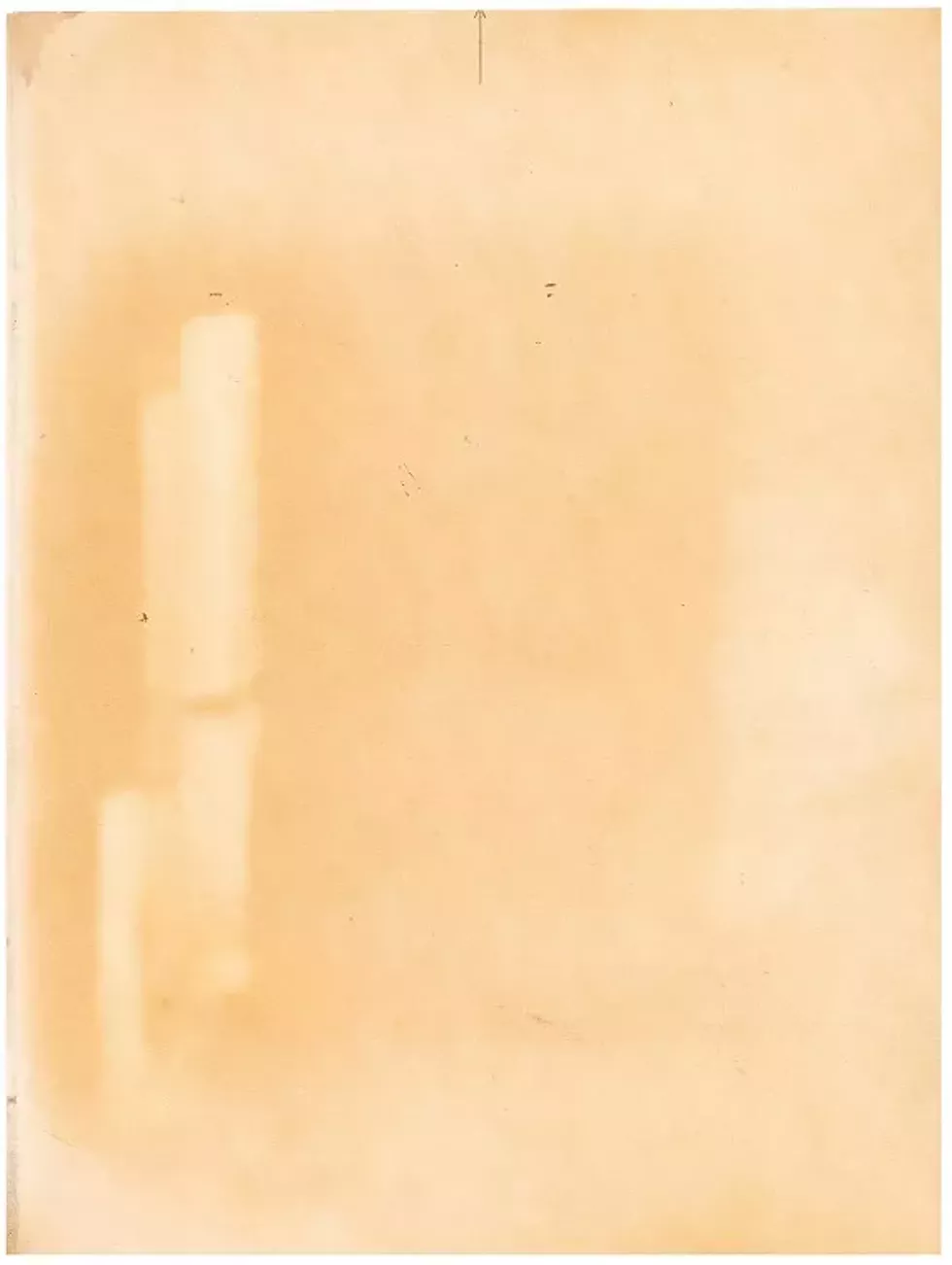 91cb3c8a_sisto-pressure_burns-06.webp